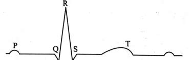 Study the graphical representation of ECG and select the correct option.