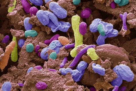 Painful fibromyalgia may be caused by the wrong kind of gut microbes ...