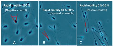 Pathogens | Special Issue : Detection of Indoor Fungi