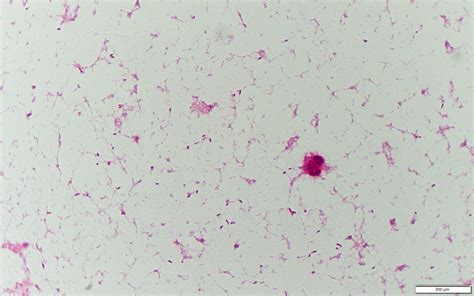 Haemophilus influenzae〔インフルエンザ桿菌〕 | グラム染色: Gram Stain