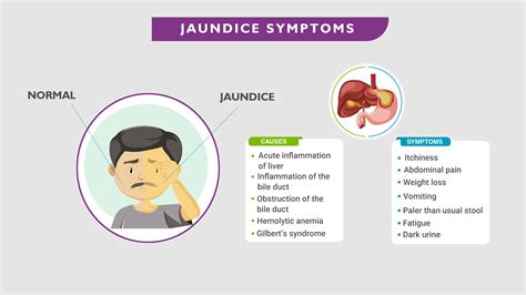 Describe Jaundice and What Causes It