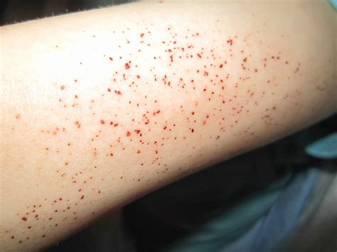 Behind Blue Eyes....: worst 10 seconds of my life.