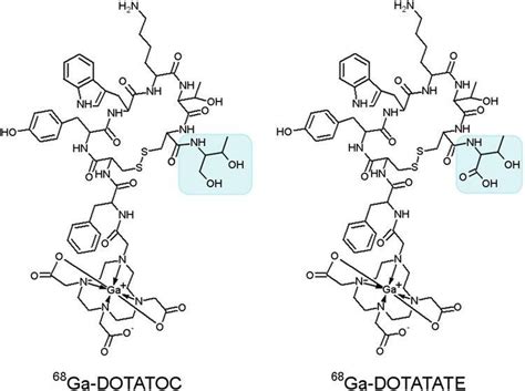 Image result for DOTA-TATE Scan