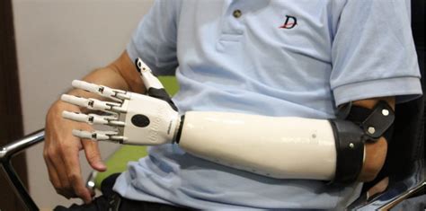 Image result for Bebionic Hand Users