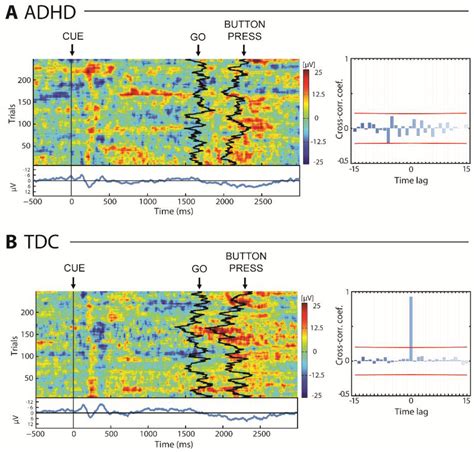 EEG Dynamics of a Go/Nogo Task in Children with ADHD