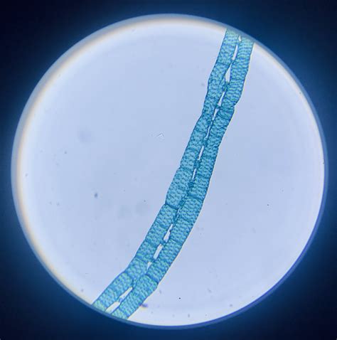 Spirogyra Under Compound Microscope