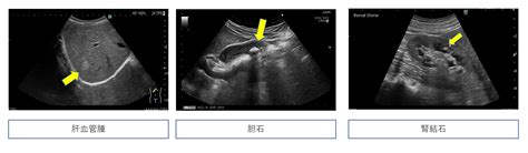 Image result for Alien Jnr Bluebery