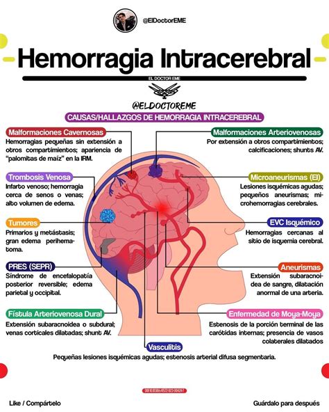 Hemorragia intracraneal | Material de enfermeria, Cosas de enfermeria ...