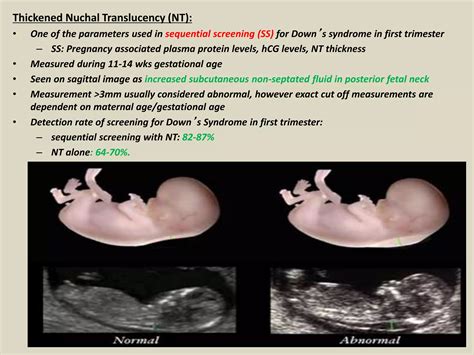 Presentation1.pptx, ultrasound examination of the 1st trimester pregnancy. | PPTX