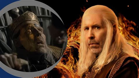 How do you contract leprosy? Symptoms explored as House of the Dragon ...