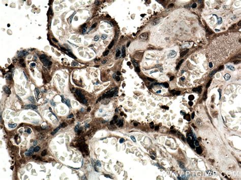 CLIC3 antibody (15971-1-AP) | Proteintech