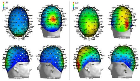 Electroencephalogram (EEG) Alpha Power as a Marker of Visuospatial ...