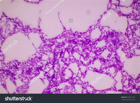 Image result for Bacteria Microscope Slides