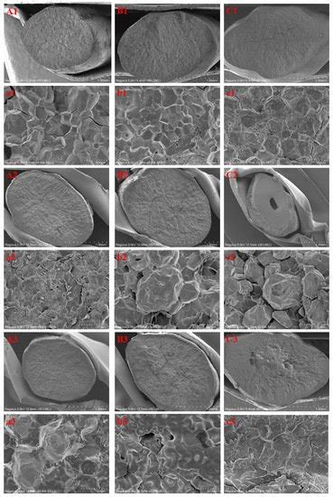 Microstructure, Digestibility and Physicochemical Properties of Rice ...