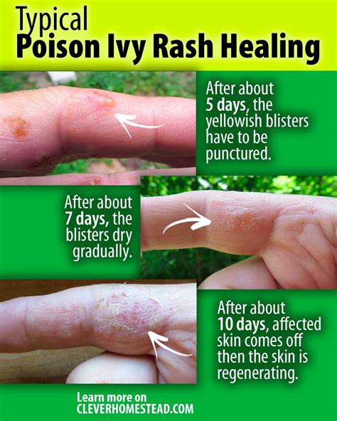 Identifying Poison Ivy Poison Oak And Poison Sumac Hgtv A Field Guide ...