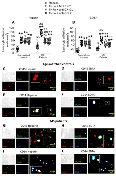 Systemic Inflammation in Metabolic Syndrome: Increased Platelet and ...