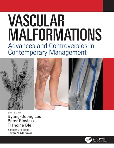 Buy Vascular Malformations: Advances and Controversies in Contemporary ...