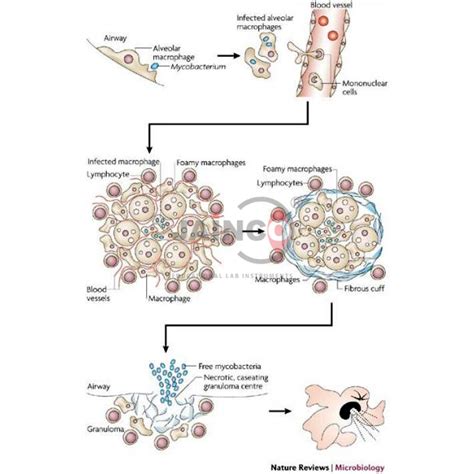 Mycobacterium Species Model