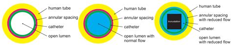 Internal Coating of Ureteral Stents with Chemical Vapor Deposition of ...