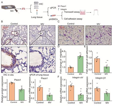 High Stretch Associated with Mechanical Ventilation Promotes Piezo1 ...