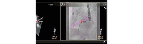 Philips - EchoNavigator