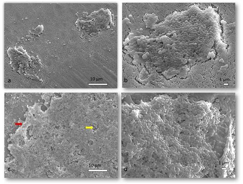Streptococcus Salivarius Morphology