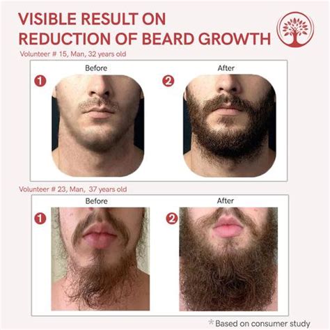 Premium Beard Serum | Fuller & Healthier Beards