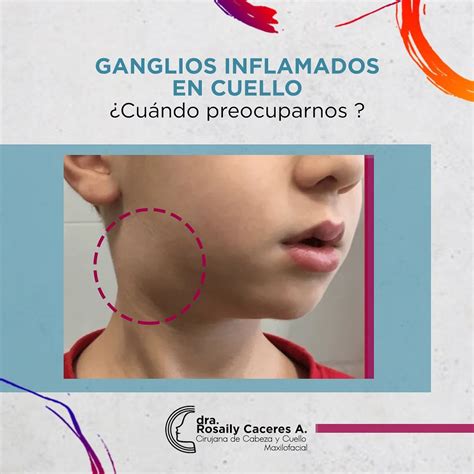 Ganglios Linfaticos En El Cuello Sintomas Text