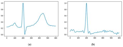 Myocardial Infarction Classification Based on Convolutional Neural ...