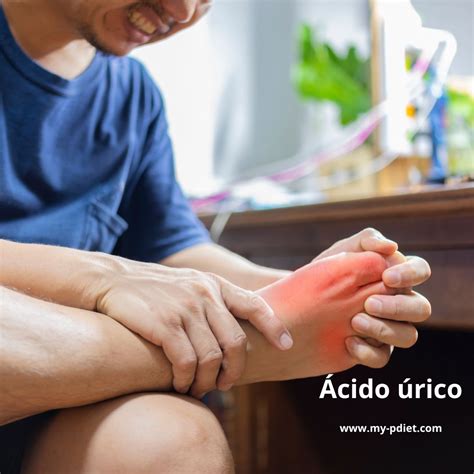 Ácido úrico y su tratamiento nutricional - My-PDiet.com - Nutrición