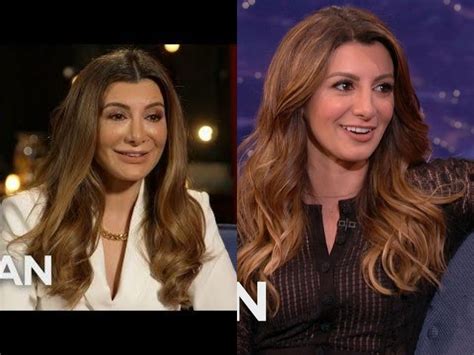 Nasim Pedrad Face Surgery
