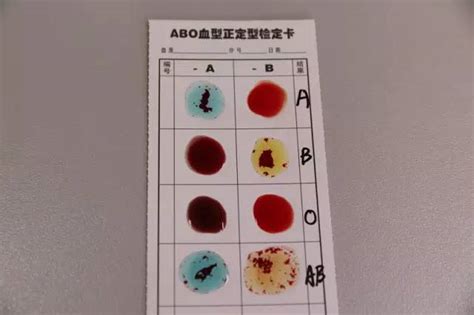 ABO血型除了用于输血之外，还有什么用途？-血型除了用于输血之外，还有什么用途？