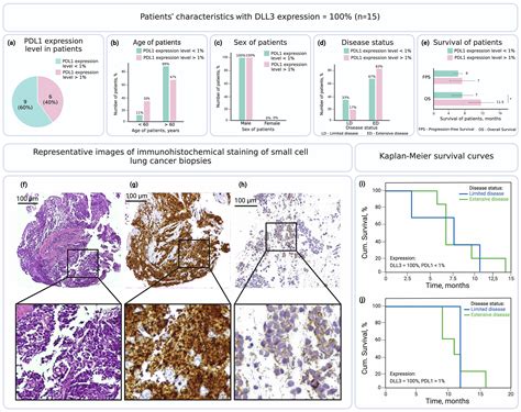 Expression patterns and clinical implications of PDL1 and DLL3 ...