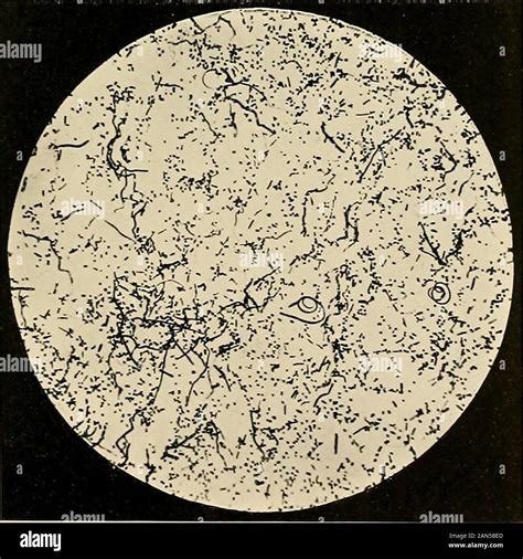 Ringworm in the light of recent research : pathology, treatment, prophylaxis . Fig. fl.—Hair of ...