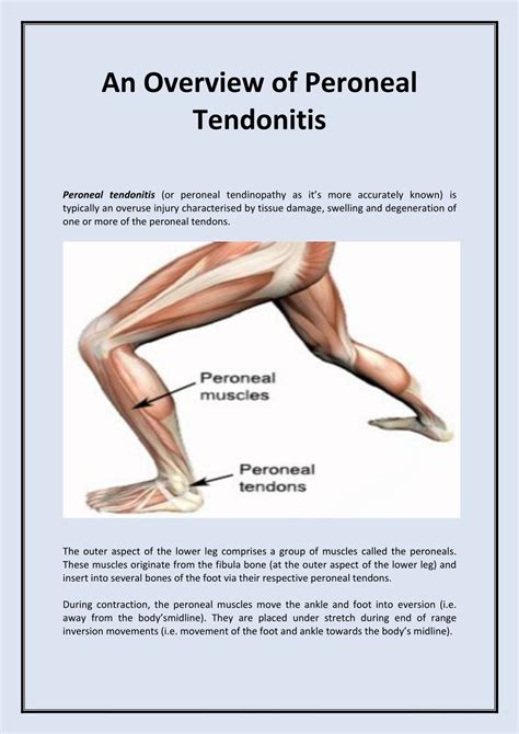 Peroneal Tendon Stretches