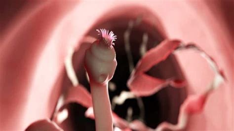 Tapeworms: শীতের ৪ সবজিতে গিজগিজ করে ফিতাকৃমি, শরীরে ঢুকে সোজা চলে যায় ...