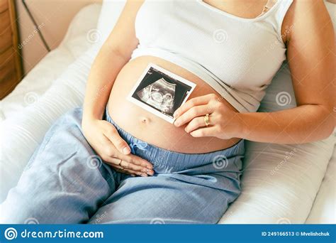 Ultrasound Picture Pregnant Baby Photo. Woman Holding Ultrasound ...