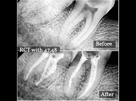 Treatments - Auora ENT Hospital And Dental Clinic