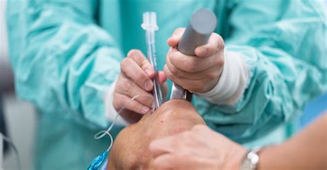 Image result for EDG Procedures