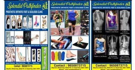 Insoles - Foot Insoles,Artificial Limbs,Cosmetics Restoration,