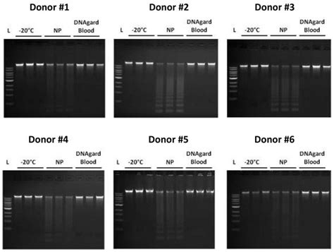 Long-term Storage of Blood in DNAgard® Blood