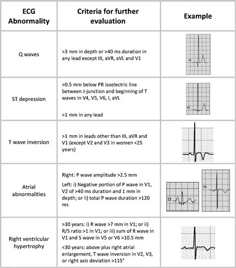 Interpretation of the Electrocardiogram of Young Athletes | Circulation