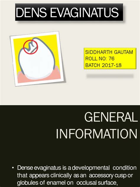 Image result for Ggdendrogram Color