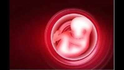 Maharashtra woman moves Supreme Court to abort 'abnormal' 24-week-old ...