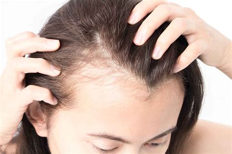 10 Common Hair Problems and Natural Solutions