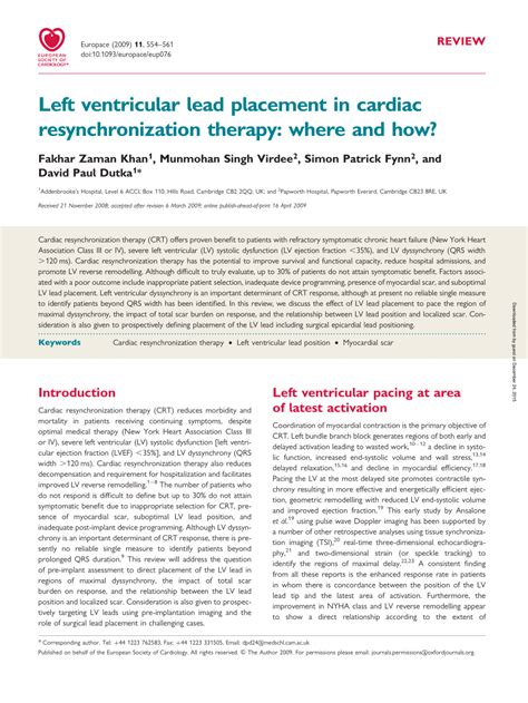 Image result for Synchronized Cardioversion Lead Placement