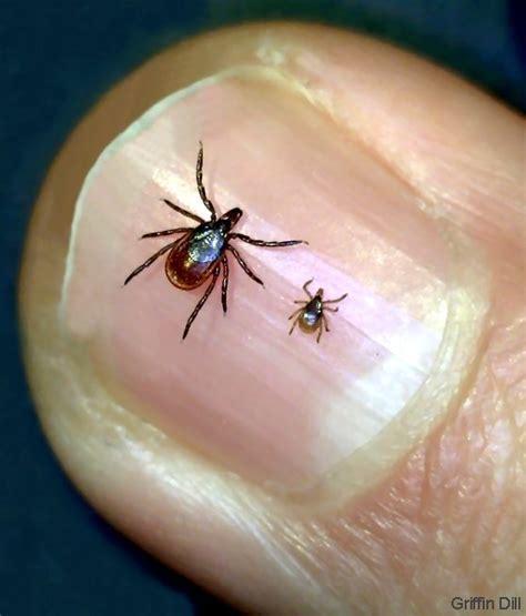 Image result for Embedded Deer Tick