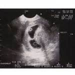 新手妈妈，记录孕期肚子变化_图1-3 9月20号孕11周_宝宝树