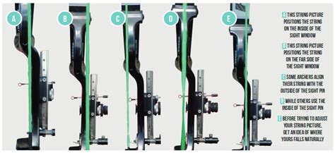 String Alignment Recurve 的图像结果