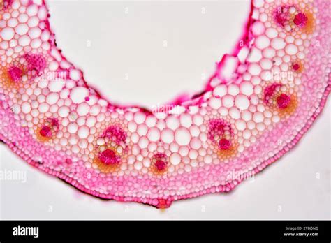 Eudicot stem (Sambucus nigra) showing epidermis, collenchyma, cortex ...